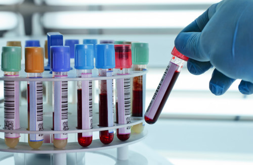 Labormedizin bei Labor Staber